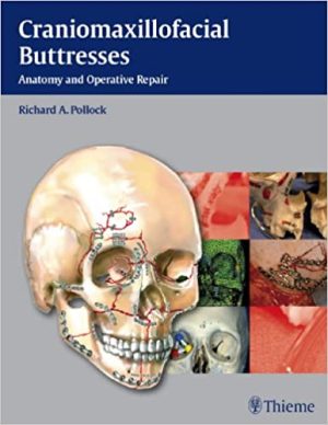 Craniomaxillofacial Buttresses Anatomy and Operative Repair