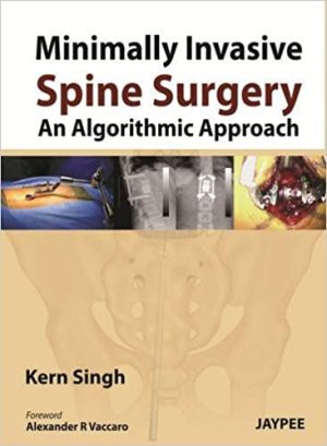Minimally Invasive Spine Surgery An Algorithmic Approach