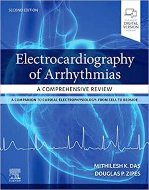 Electrocardiography of Arrhythmias A Comprehensive Review 2nd Edition