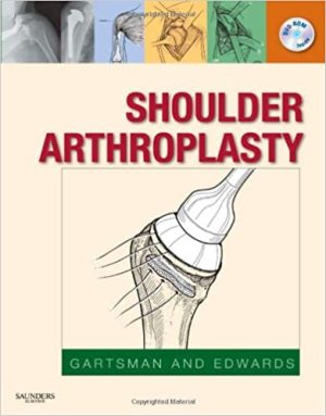 Shoulder Arthroplasty