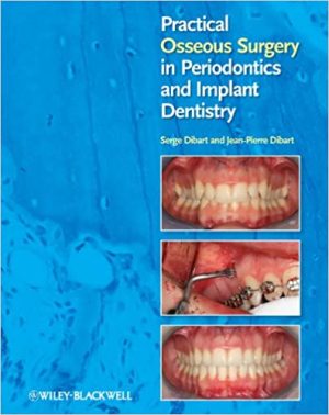 Practical Osseous Surgery In Periodontics And Implant Dentistry
