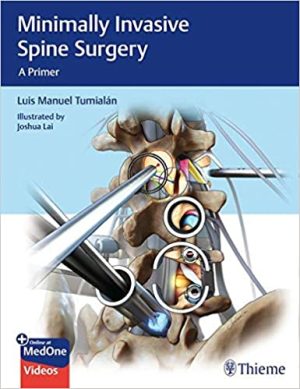 Minimally Invasive Spine Surgery A Primer