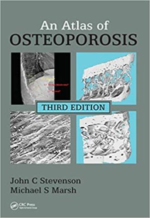 An Atlas of Osteoporosis 3rd Edition