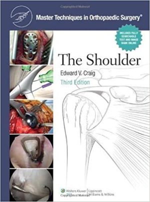 The Master Techniques in Orthopaedic Surgery Shoulder 3rd Edition