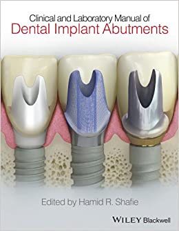 Clinical And Laboratory Manual Of Dental Implant Abutments