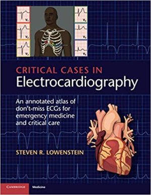 Critical Cases in Electrocardiography An Annotated Atlas of Dont Miss ECGs for Emergency Medicine and Critical Care