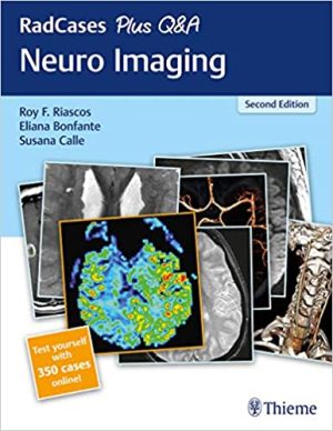 RadCases Plus Q&A Neuro Imaging 2nd Ed