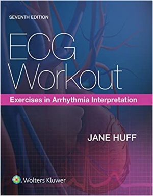 ECG Workout Exercises in Arrhythmia Interpretation 7th Edition