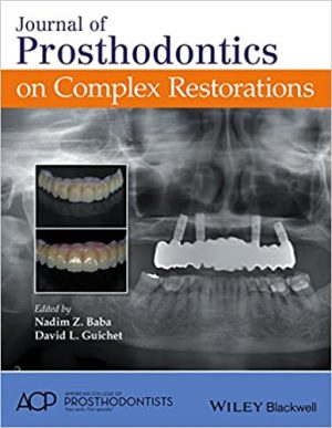 Journal of Prosthodontics on Complex Restorations