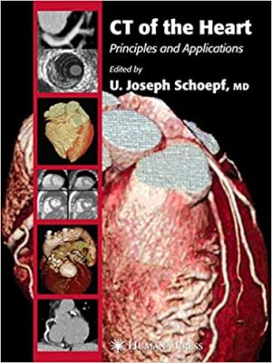 CT of the Heart Principles and Applications