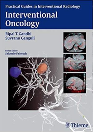 Interventional Oncology