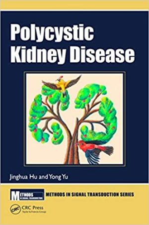 Polycystic Kidney Disease By Jinghua Hu