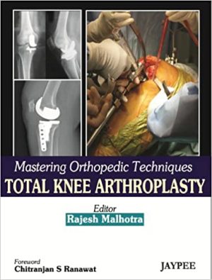 Mastering Orthopedic Techniques Total Knee Arthroplasty