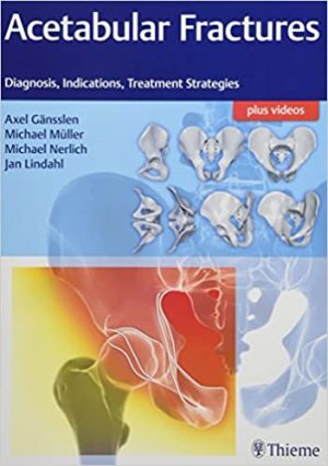 Acetabular Fractures Diagnosis Indications Treatment Strategies