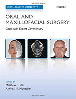 Challenging Concepts in Oral and Maxillofacial Surgery Cases with Expert Commentary