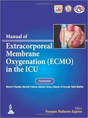 Manual of Extracorporeal Membrane Oxygenation Ecmo in the ICU