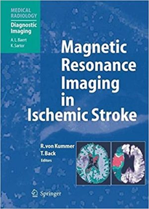 Magnetic Resonance Imaging in Ischemic Stroke