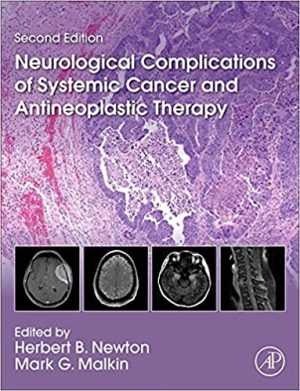 Neurological Complications of Systemic Cancer and Antineoplastic Therapy 2nd Edition