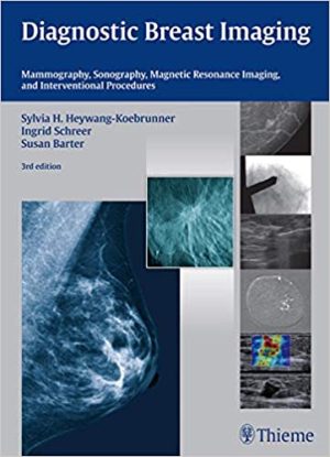Diagnostic Breast Imaging Mammography Sonography MRI and Interventional Procedures 3rd Ed