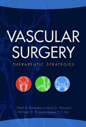 Vascular Surgery Therapeutic Strategies