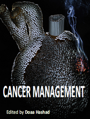 Cancer Management