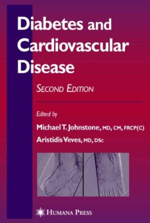 Diabetes and Cardiovascular Disease 2nd Ed