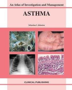 Asthma An Atlas of Investigation and Diagnosis