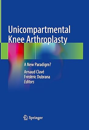 Unicompartmental Knee Arthroplasty A New Paradigm
