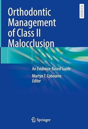 Orthodontic Management of Class II Malocclusion An Evidence Based Guide