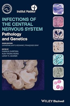 Infections of the Central Nervous System Pathology and Genetics