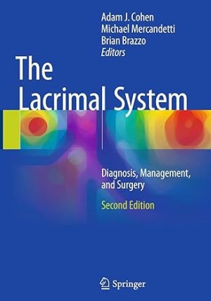 The Lacrimal System Diagnosis Management and Surgery 2nd Edition