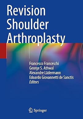 Revision Shoulder Arthroplasty