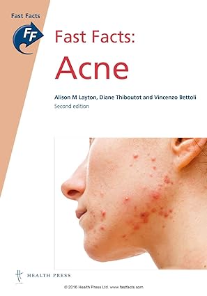 Fast Facts Acne