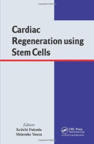 Cardiac Regeneration Using Stem Cells