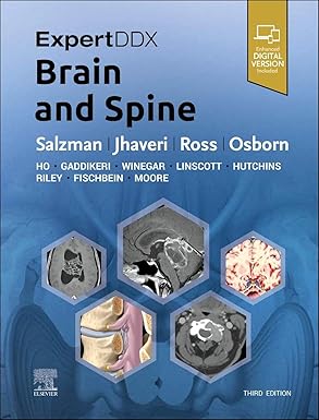 ExpertDDx Brain and Spine 3rd Edition