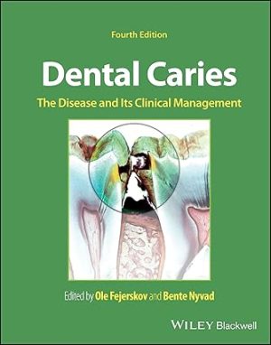 Dental Caries The Disease and its Clinical Management 4th Edition