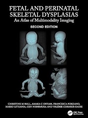 Fetal and Perinatal Skeletal Dysplasias An Atlas of Multimodality Imaging 2nd Edition