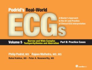 Podrids Real World Ecgs Volume 5 Narrow and Wide Complex Tachyarrhythmias and Aberration Part B Practice Cases
