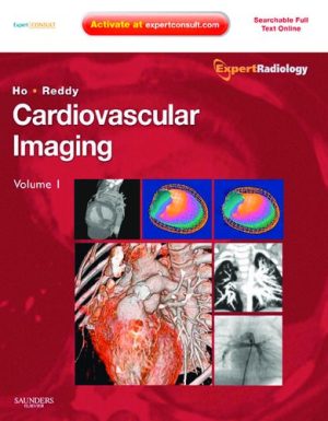 Cardiovascular Imaging