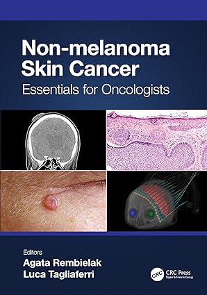 Non melanoma Skin Cancer Essentials for Oncologists by Agata Rembielak