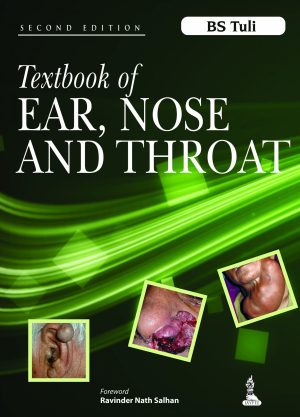 Textbook of Ear Nose and Throat