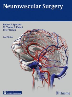 Neurovascular Surgery 2nd Edition
