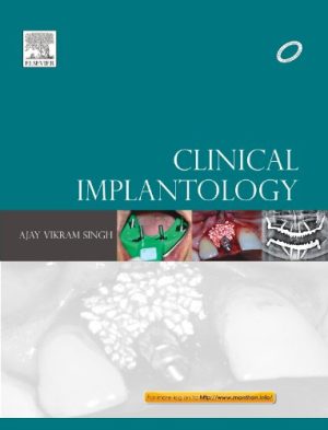 Clinical Implantology By Ajay Vikram Singh