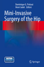 Mini Invasive Surgery of the Hip