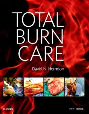 Total Burn Care 5th Edition