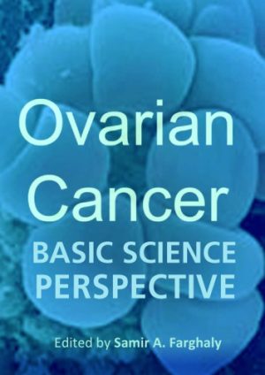 Ovarian Cancer Basic Science Perspective