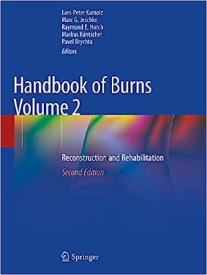 Handbook of Burns Volume 2 Reconstruction and Rehabilitation