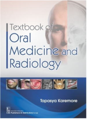 Textbook of Oral Medicine And Radiology