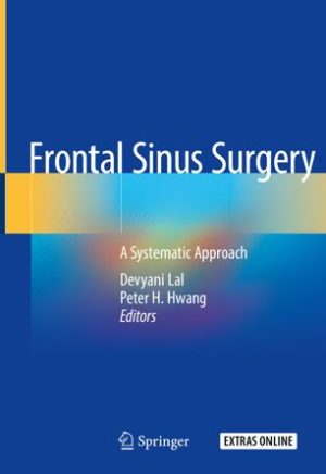 Frontal Sinus Surgery A Systematic Approach