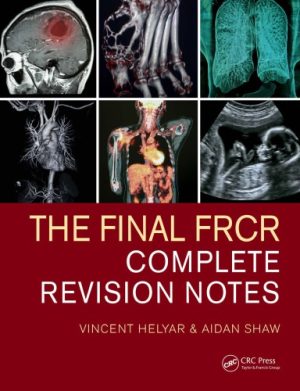 The Final FRCR Complete Revision Notes